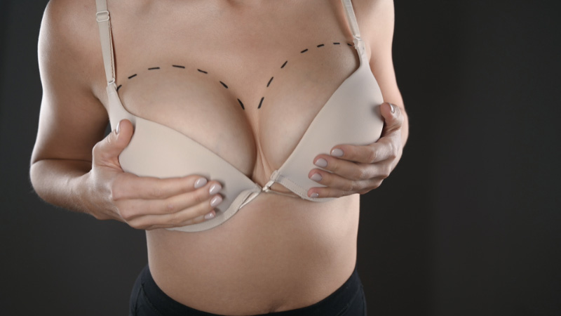 Woman's Boobs With Line For Breasts Implantation Surgery Concept