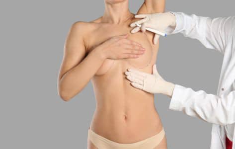 Breast implant removal and replacement recovery