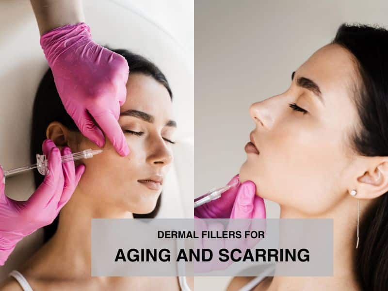 dermal fillers for aging and scarring