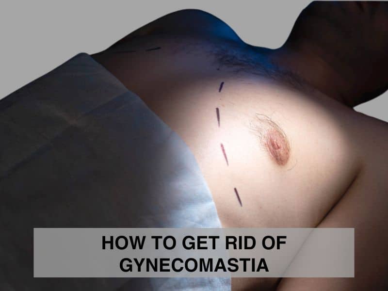 How to Get Rid of Gynecomastia