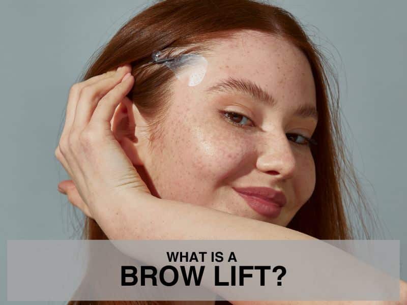 What is a Brow Lift