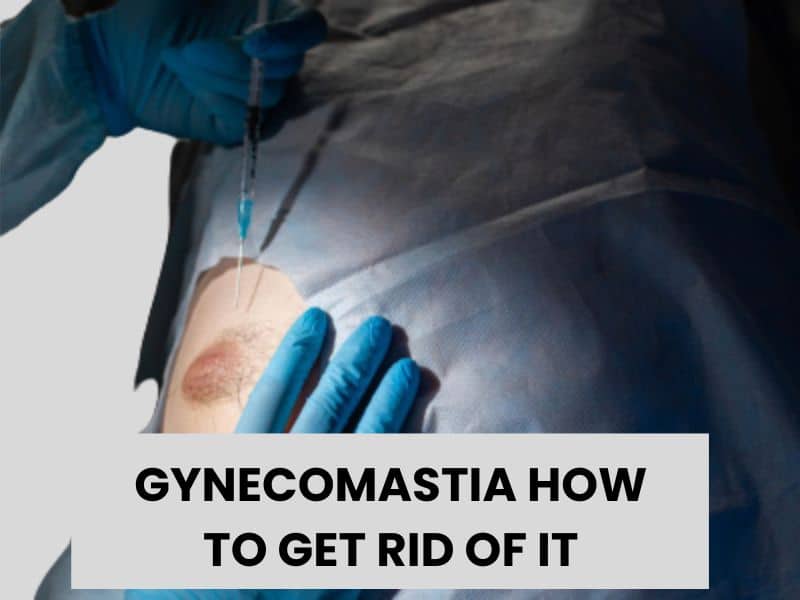 gynecomastia how to get rid of it