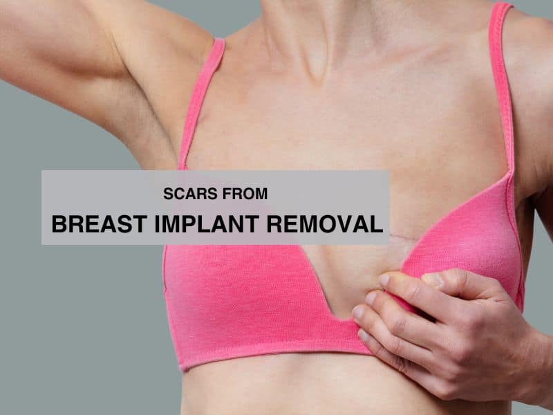 scars from breast implant removal